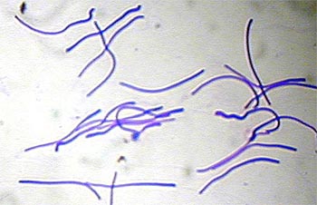 Spermien des Regenwurms unterm Lichtmikroskop
